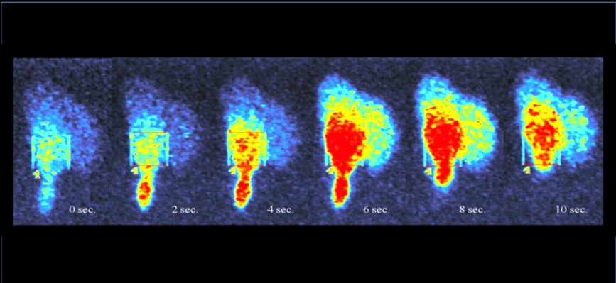 Psuedocolor calcium transient