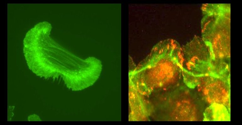 Cytoskeletal dynamics