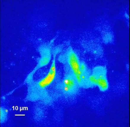 Calcium transients in cell sheet