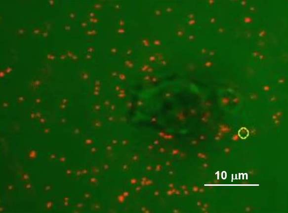 Dictyostelium on gelatin surface